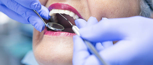 Best Emergency Dentist for Lost Fillings or Crowns in Mitchellville, IA